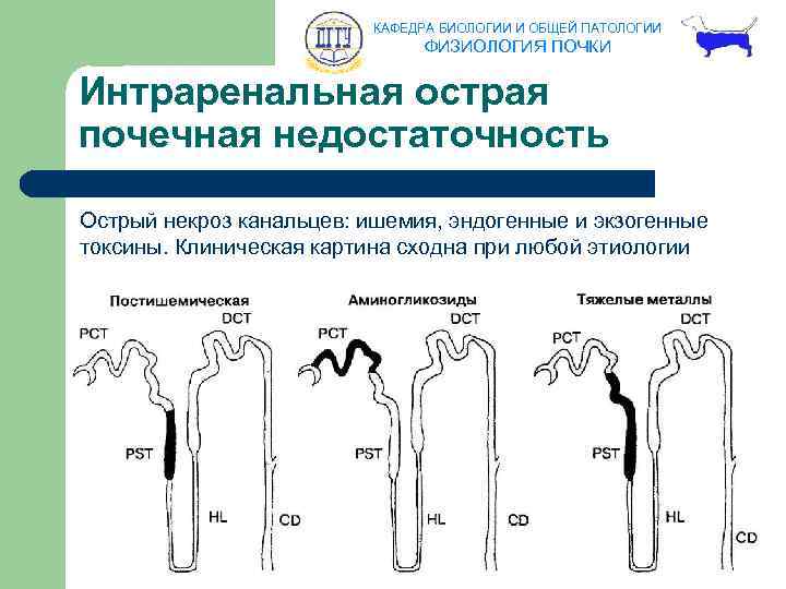 КАФЕДРА БИОЛОГИИ И ОБЩЕЙ ПАТОЛОГИИ ФИЗИОЛОГИЯ ПОЧКИ Интраренальная острая почечная недостаточность Острый некроз канальцев: