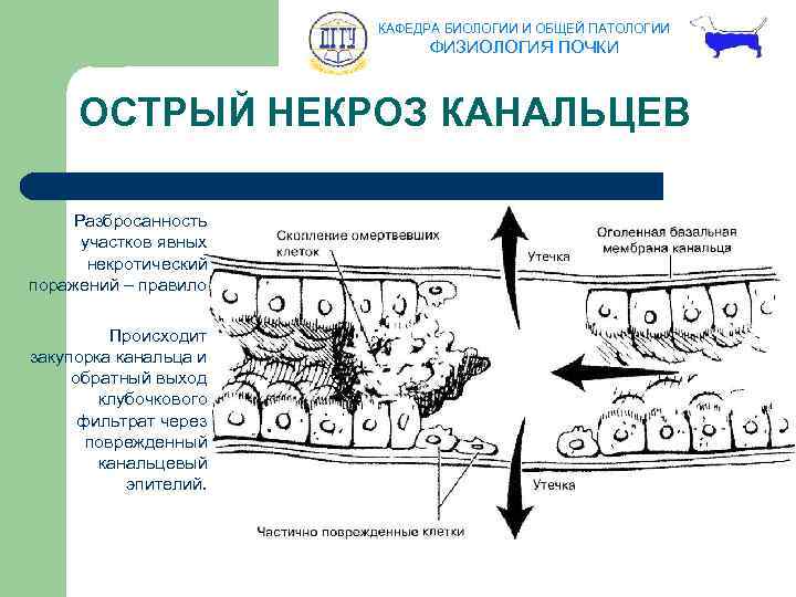 КАФЕДРА БИОЛОГИИ И ОБЩЕЙ ПАТОЛОГИИ ФИЗИОЛОГИЯ ПОЧКИ ОСТРЫЙ НЕКРОЗ КАНАЛЬЦЕВ Разбросанность участков явных некротический