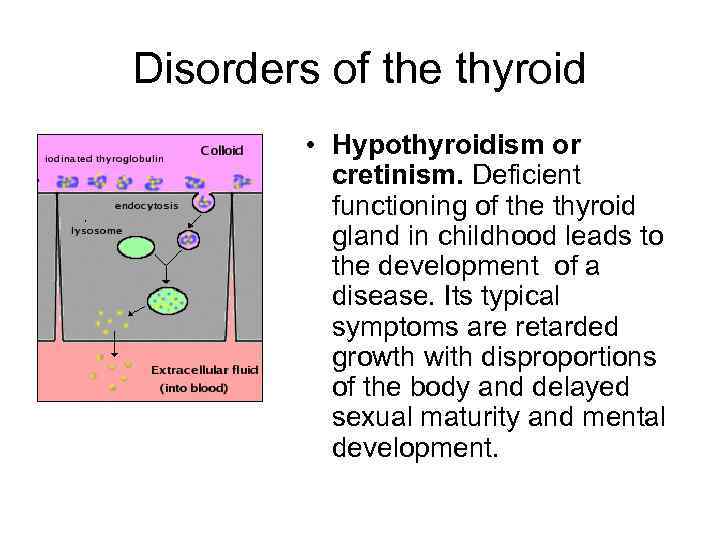 Disorders of the thyroid • Hypothyroidism or cretinism. Deficient functioning of the thyroid gland