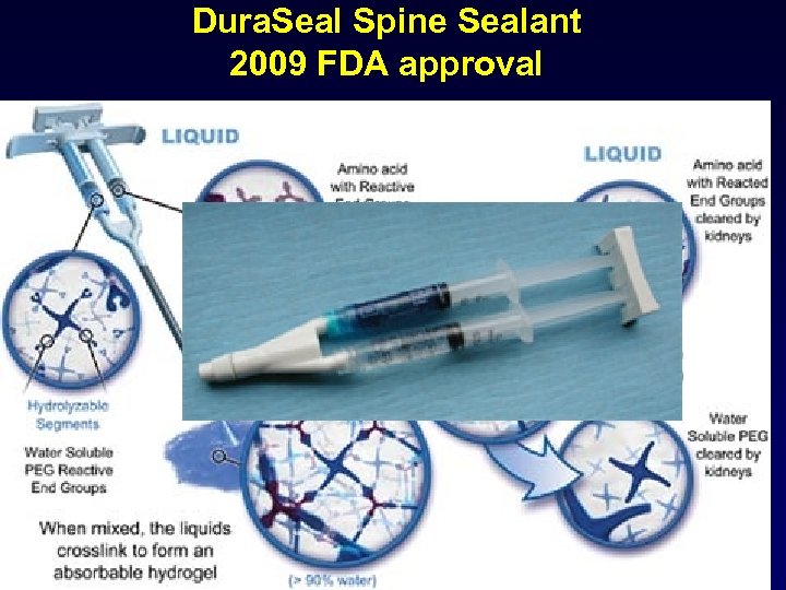 Dura. Seal Spine Sealant 2009 FDA approval 