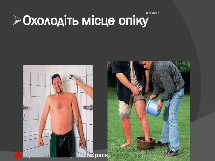 ожоги ØОхолодіть місце опіку Армянское Общество Красного Креста 