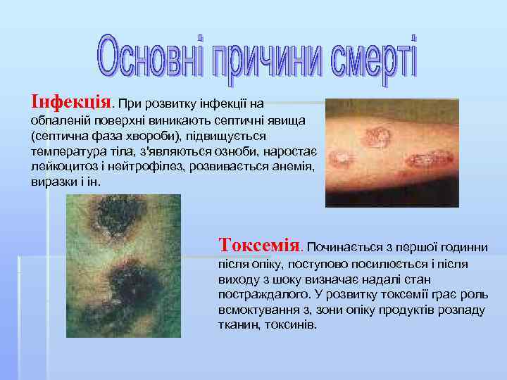 Інфекція. При розвитку інфекції на обпаленій поверхні виникають септичні явища (септична фаза хвороби), підвищується