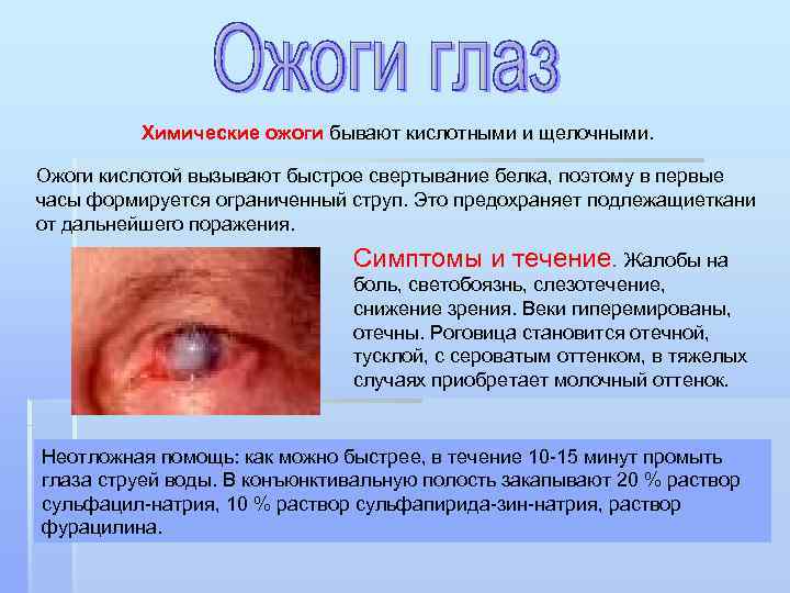 Химические ожоги бывают кислотными и щелочными. Ожоги кислотой вызывают быстрое свертывание белка, поэтому в