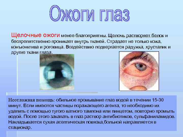 Щелочные ожоги менее благоприятны. Щелочь растворяет белок и беспрепятственно проникает внутрь тканей. Страдает не