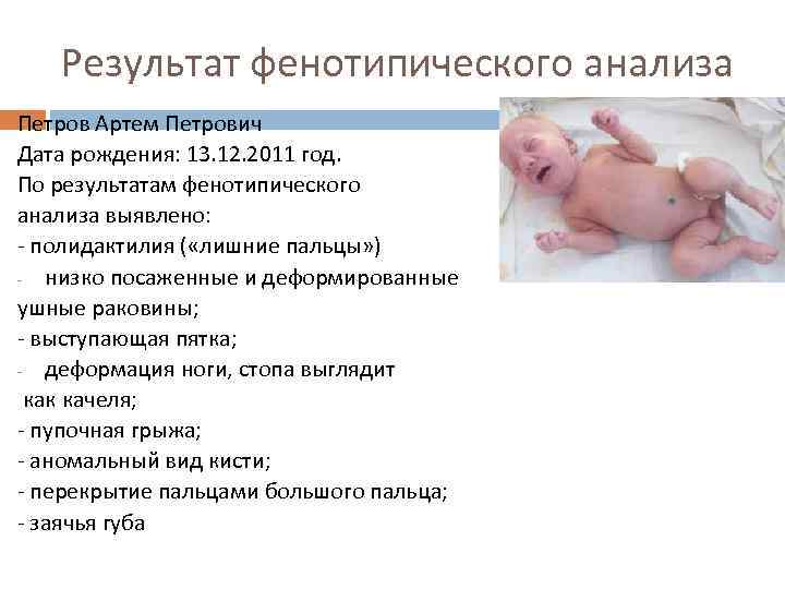 Результат фенотипического анализа Петров Артем Петрович Дата рождения: 13. 12. 2011 год. По результатам