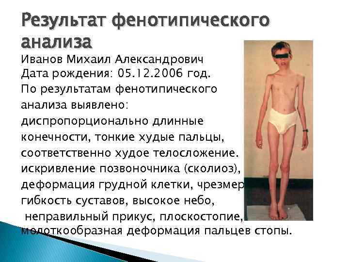 Результат фенотипического анализа Иванов Михаил Александрович Дата рождения: 05. 12. 2006 год. По результатам