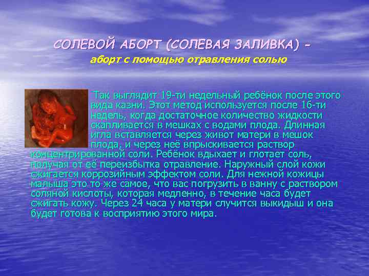 СОЛЕВОЙ АБОРТ (СОЛЕВАЯ ЗАЛИВКА) аборт с помощью отравления солью Так выглядит 19 -ти недельный