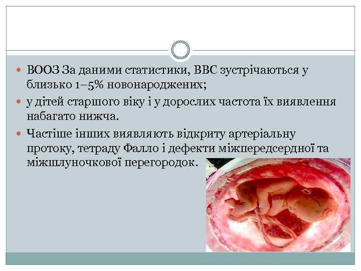  ВООЗ За даними статистики, ВВС зустрічаються у близько 1– 5% новонароджених; у дітей