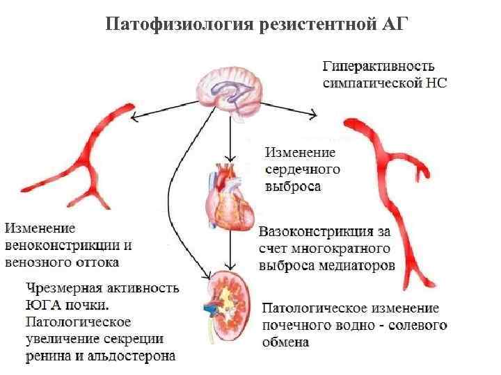 Патофизиология резистентной АГ 