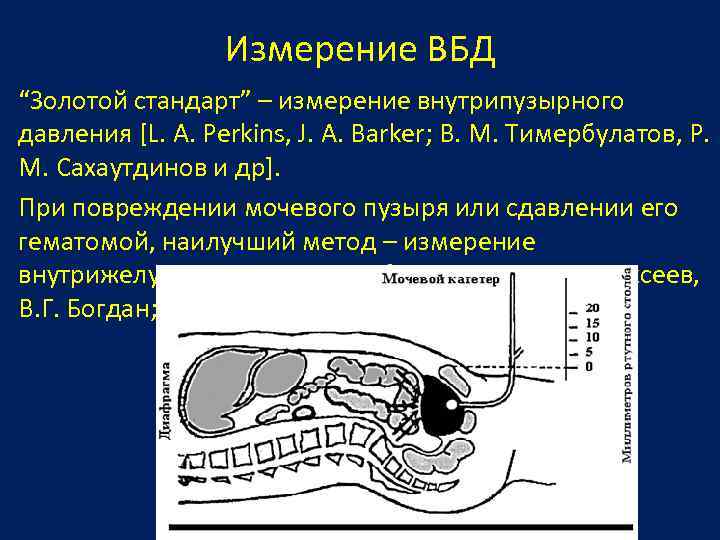 Измерение ВБД “Золотой стандарт” – измерение внутрипузырного давления [L. A. Perkins, J. A. Barker;