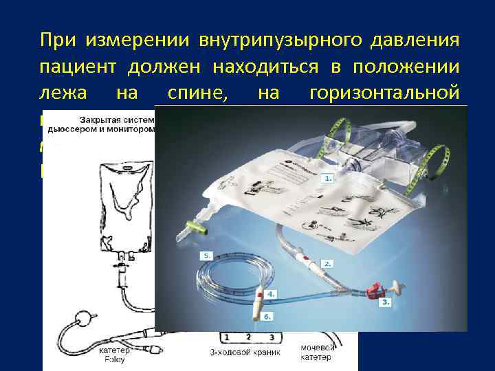 Внутрибрюшное давление. Метод измерения внутрибрюшного давления. Измерение внутрибрюшного давления через мочевой пузырь. Аппарат внутрибрюшного давления. Аппарат для измерения внутрибрюшного давления.