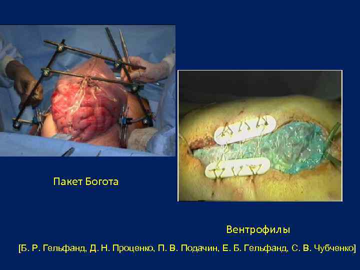 Пакет Богота Вентрофилы [Б. Р. Гельфанд, Д. Н. Проценко, П. В. Подачин, Е. Б.