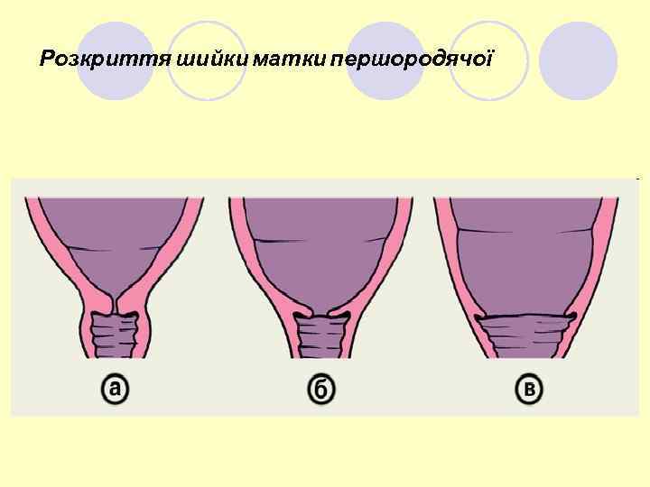 Розкриття шийки матки першородячої 