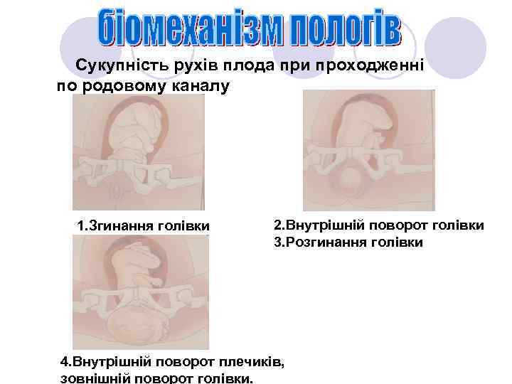 Сукупність рухів плода при проходженні по родовому каналу 1. Згинання голівки 2. Внутрішній поворот