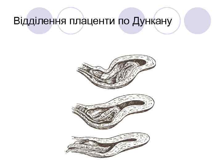 Відділення плаценти по Дункану 