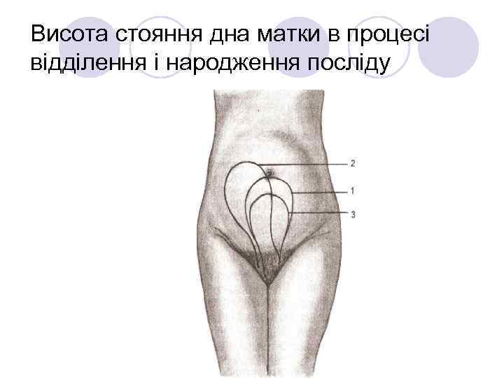 Висота стояння дна матки в процесі відділення і народження посліду 