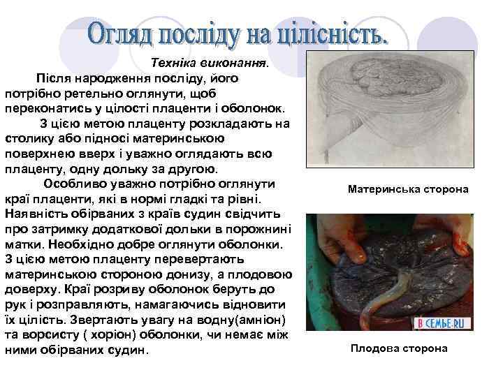 Техніка виконання. Після народження посліду, його потрібно ретельно оглянути, щоб переконатись у цілості плаценти