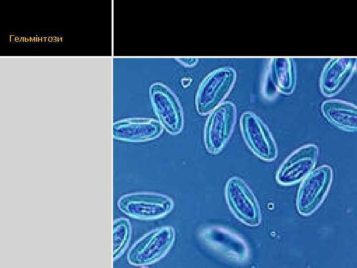 Гельмінтози 