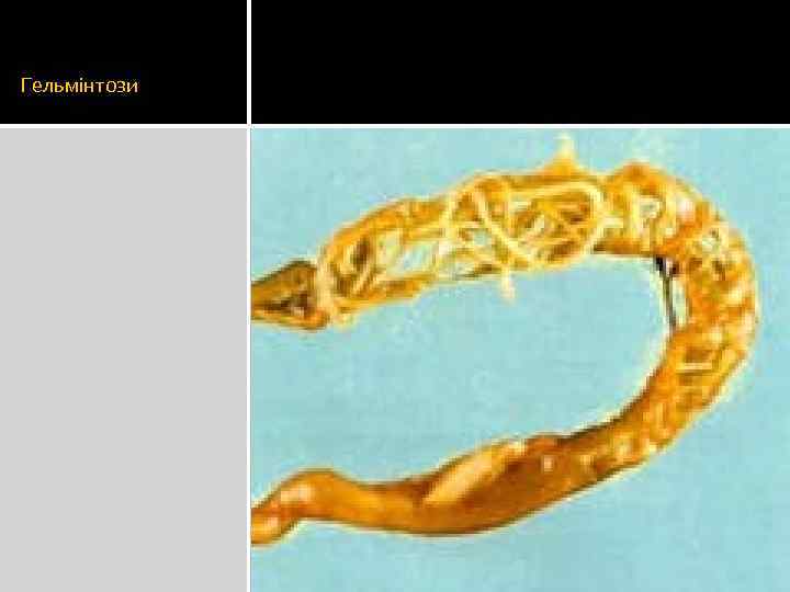 Гельмінтози 