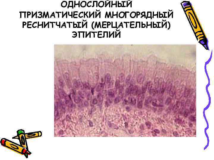 ОДНОСЛОЙНЫЙ ПРИЗМАТИЧЕСКИЙ МНОГОРЯДНЫЙ РЕСНИТЧАТЫЙ (МЕРЦАТЕЛЬНЫЙ) ЭПИТЕЛИЙ 