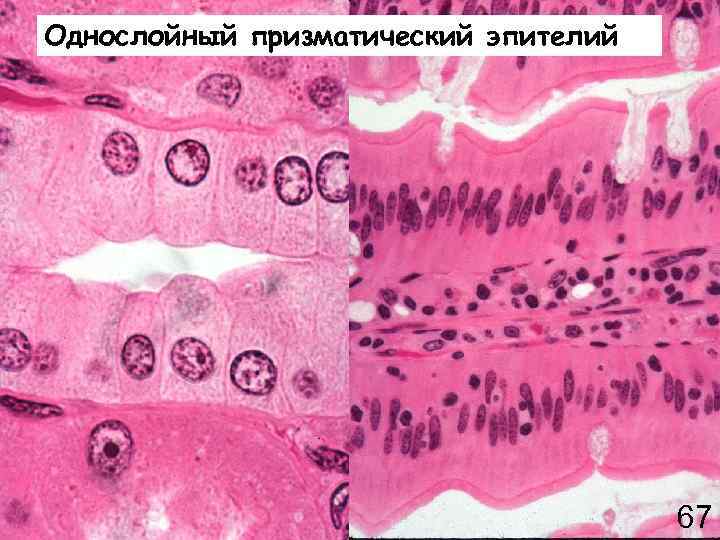 Однослойный призматический эпителий 67 