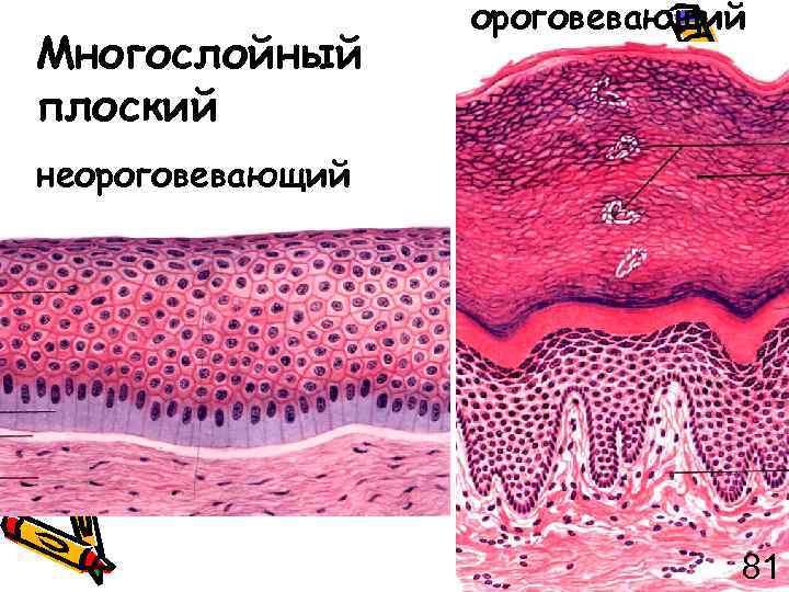 Многослойный плоский ороговевающий неороговевающий 81 