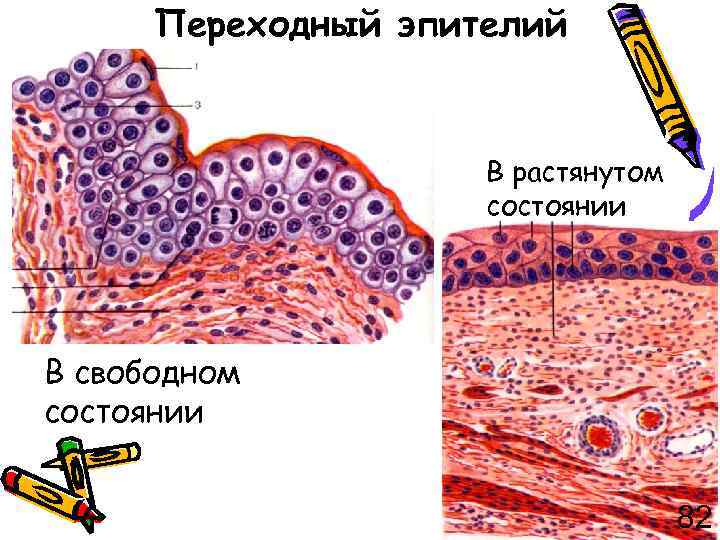 Переходный эпителий В растянутом состоянии В свободном состоянии 82 