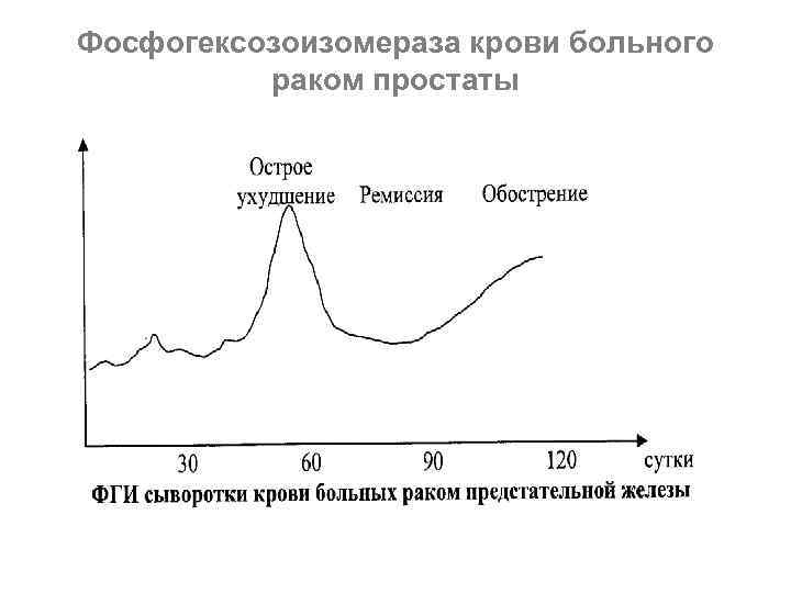 Фосфогексозоизомераза крови больного раком простаты 