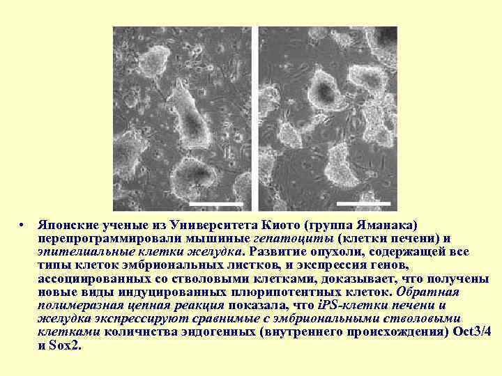  • Японские ученые из Университета Киото (группа Яманака) перепрограммировали мышиные гепатоциты (клетки печени)