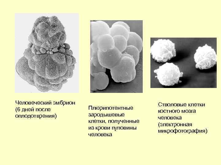 Человеческий эмбрион (6 дней после оплодотврения) Плюрипотентные зародышевые клетки, полученные из крови пуповины человека