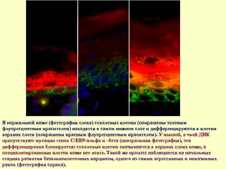 В нормальной коже (фотография слева) стволовые клетки (покрашены зеленым флуоресцентным красителем) находятся в самом