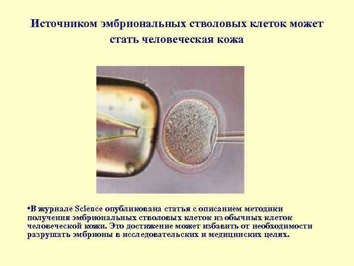 Стволовые клетки в биотехнологии презентация