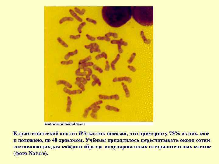 Кариотипический анализ i. PS-клеток показал, что примерно у 75% из них, как и положено,