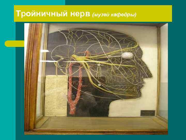 Тройничный нерв (музей кафедры) 