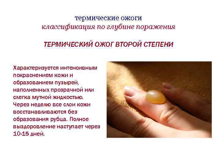 термические ожоги классификация по глубине поражения ТЕРМИЧЕСКИЙ ОЖОГ ВТОРОЙ СТЕПЕНИ Характеризуется интенсивным покраснением кожи