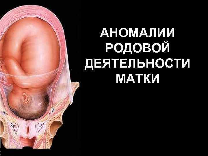 АНОМАЛИИ РОДОВОЙ ДЕЯТЕЛЬНОСТИ МАТКИ 