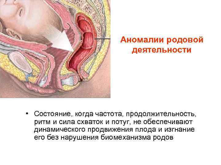 Аномалии родовой деятельности • Состояние, когда частота, продолжительность, ритм и сила схваток и потуг,