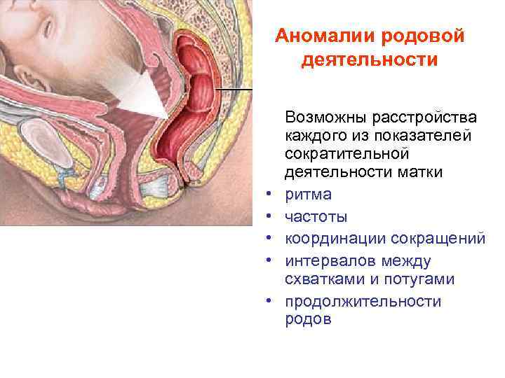 Аномалии родовой деятельности • • • Возможны расстройства каждого из показателей сократительной деятельности матки