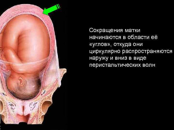 Сокращения матки начинаются в области её «углов» , откуда они циркулярно распространяются наружу и
