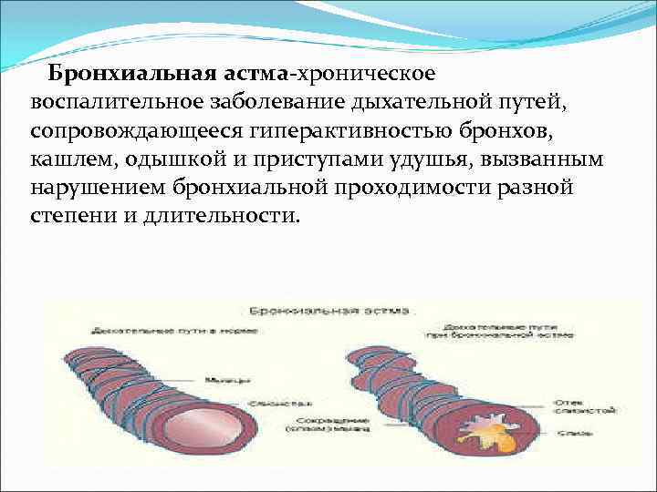 Бронхиальная астма терапия презентация