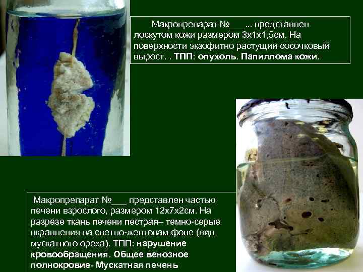 Макропрепарат №___. . . представлен лоскутом кожи размером 3 х1 х1, 5 см. На