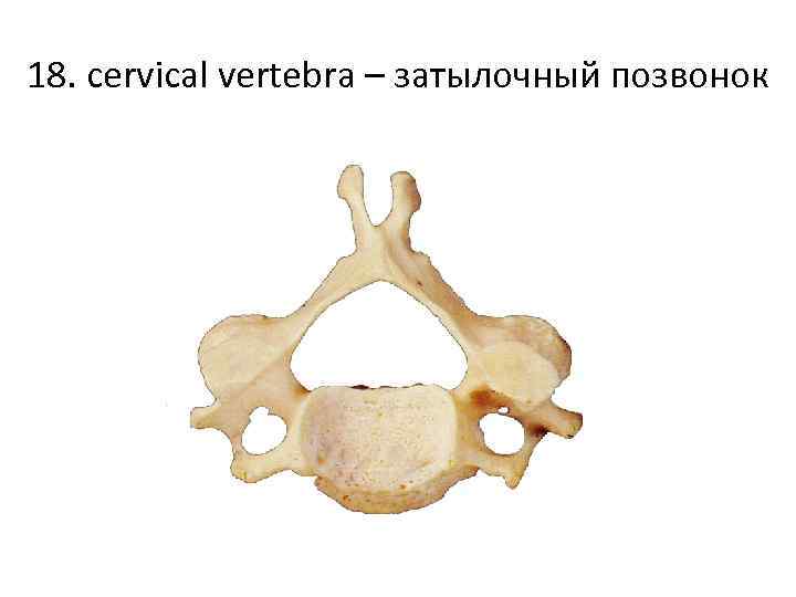 18. cervical vertebra – затылочный позвонок 