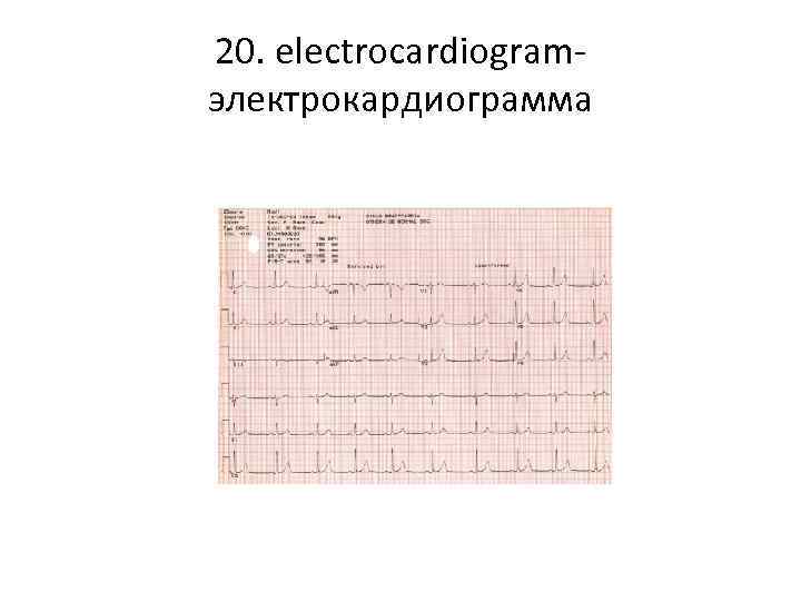 20. electrocardiogramэлектрокардиограмма 