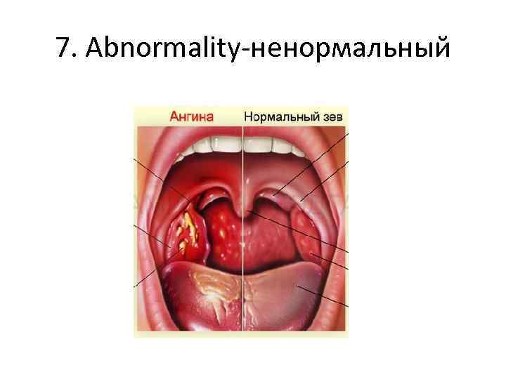 7. Abnormality-ненормальный 