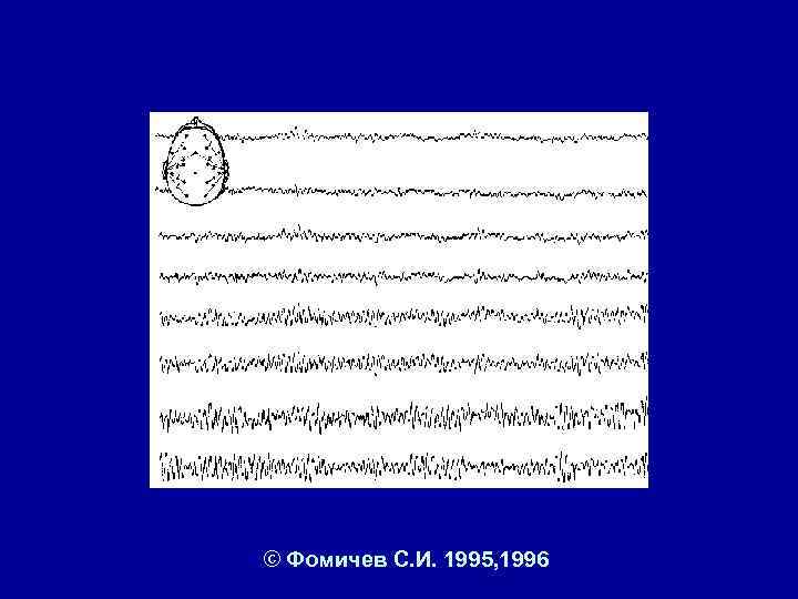 © Фомичев С. И. 1995, 1996 