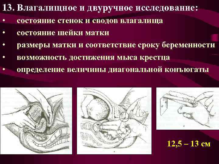 13. Влагалищное и двуручное исследование: • • • состояние стенок и сводов влагалища состояние