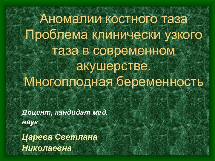 Презентация аномалии костного таза