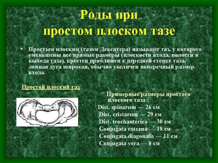 Презентация аномалии костного таза