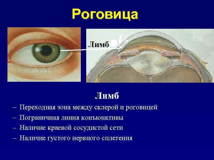 Липоидная дуга роговицы фото