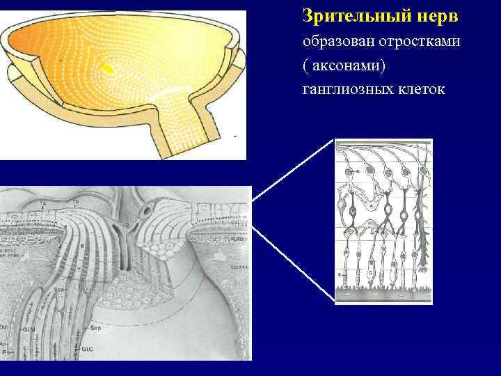 Зрительный нерв образован отростками ( аксонами) ганглиозных клеток 